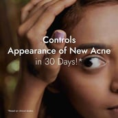 9 - Kapiva Skin Rituals Tulsi Anti-Acne Serum,  30 ml  for A Clear Skin 